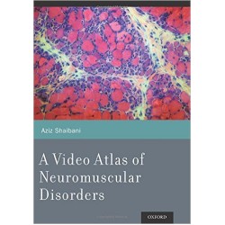 Video Atlas of Neuromuscular Disorders,A